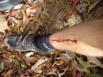Blood and Gore - A common sight at the Crescent Challenge